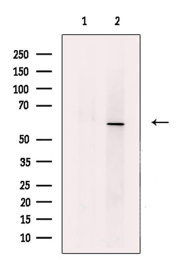 ACVR1 Antibody in Western Blot (WB)