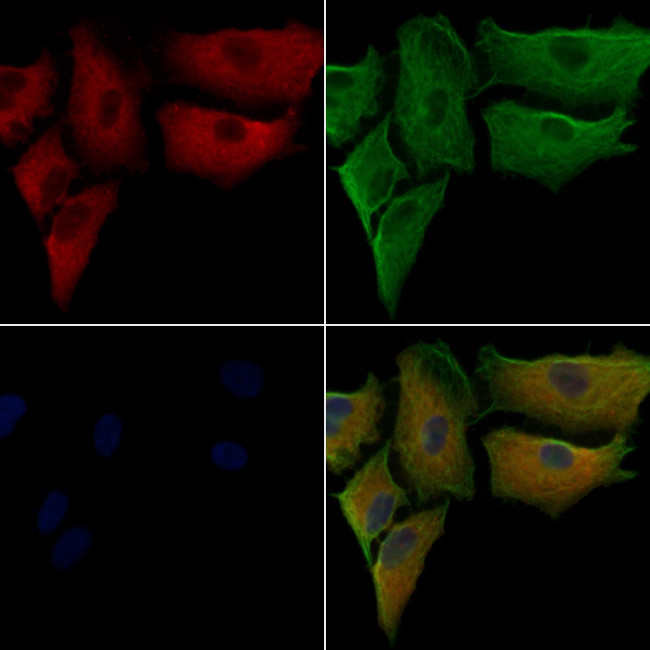 alpha Actinin 1/2/3/4 Antibody in Immunocytochemistry (ICC/IF)