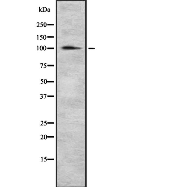 alpha Actinin 2 Antibody in Western Blot (WB)