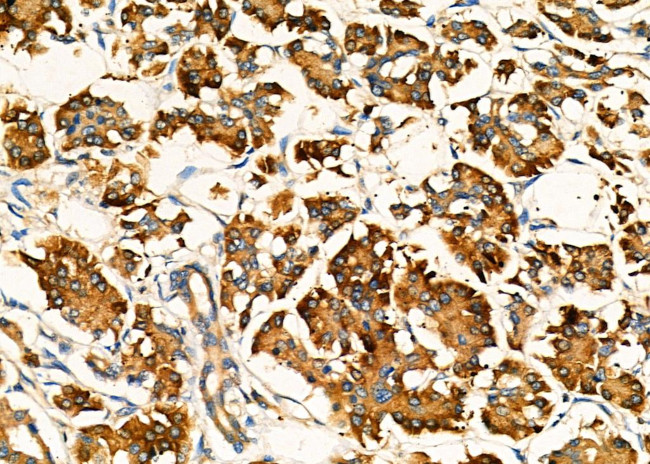 ACVR2A Antibody in Immunohistochemistry (Paraffin) (IHC (P))