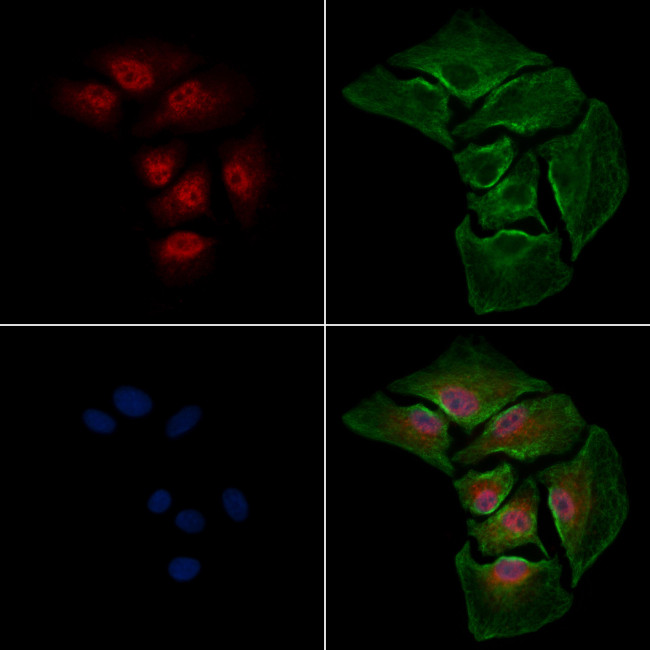 ADCY10 Antibody in Immunocytochemistry (ICC/IF)