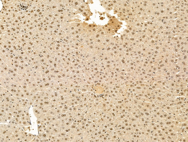 ADCY10 Antibody in Immunohistochemistry (Paraffin) (IHC (P))