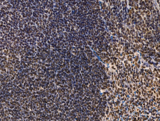 ADCY10 Antibody in Immunohistochemistry (Paraffin) (IHC (P))