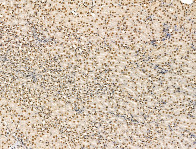 ADCY10 Antibody in Immunohistochemistry (Paraffin) (IHC (P))