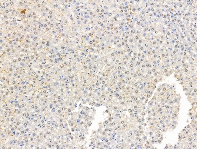 ADCY10 Antibody in Immunohistochemistry (Paraffin) (IHC (P))