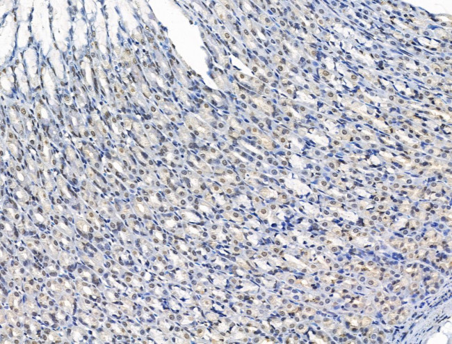 ADCY10 Antibody in Immunohistochemistry (Paraffin) (IHC (P))