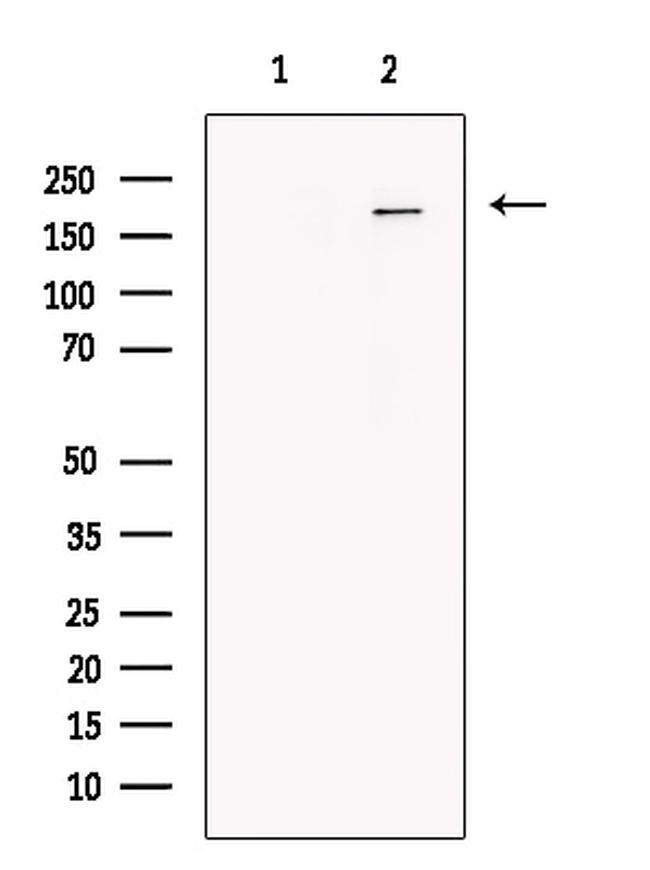 ADCY10 Antibody in Western Blot (WB)