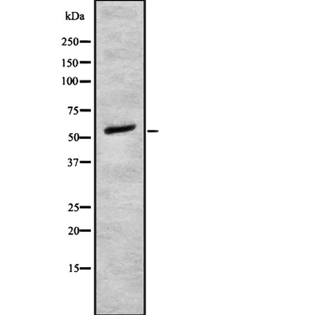 alpha-1b Adrenergic Receptor Antibody in Western Blot (WB)