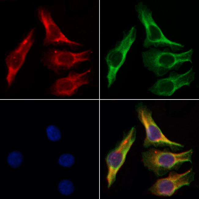 alpha-2c Adrenergic Receptor Antibody in Immunocytochemistry (ICC/IF)