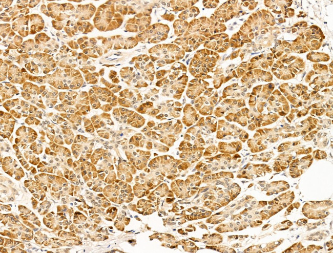 EEF1E1 Antibody in Immunohistochemistry (Paraffin) (IHC (P))