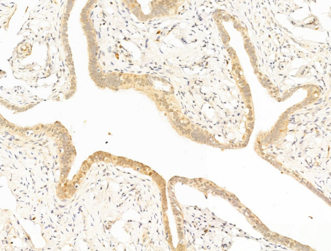 EEF1E1 Antibody in Immunohistochemistry (Paraffin) (IHC (P))