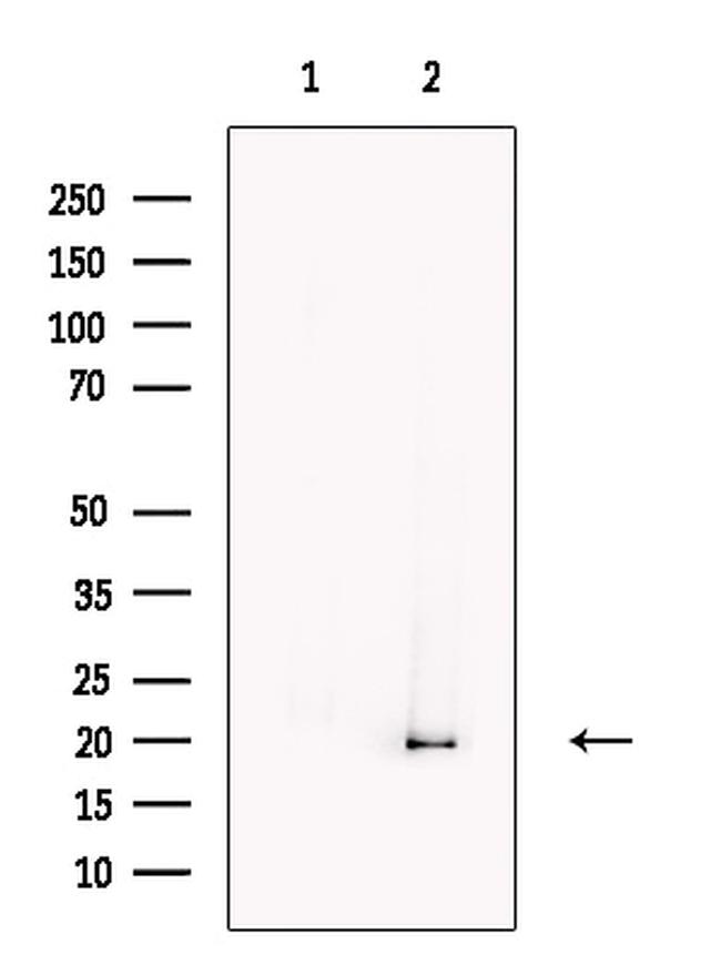 EEF1E1 Antibody in Western Blot (WB)