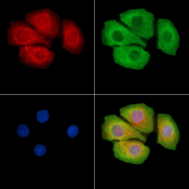 AKR1C1 Antibody in Immunocytochemistry (ICC/IF)