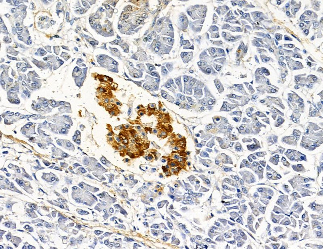 AKR1C1 Antibody in Immunohistochemistry (Paraffin) (IHC (P))