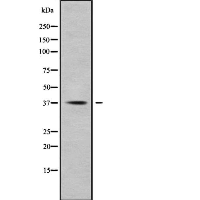 AKR1C1 Antibody in Western Blot (WB)