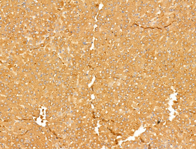 ALDH9A1 Antibody in Immunohistochemistry (Paraffin) (IHC (P))