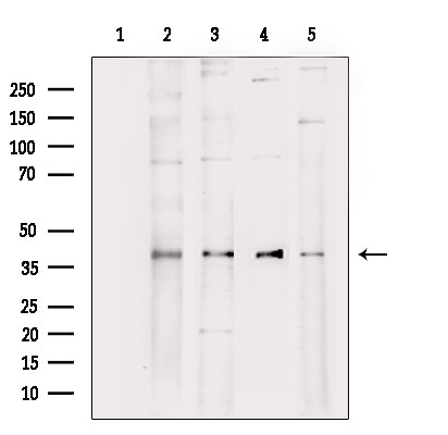 Aldolase Antibody in Western Blot (WB)