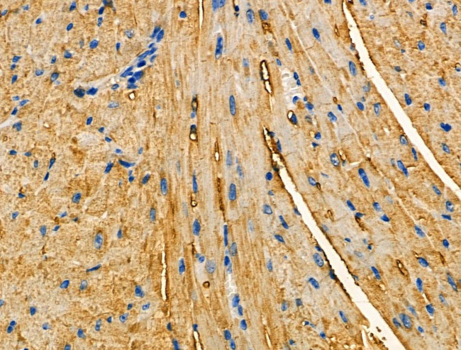 Aldolase Antibody in Immunohistochemistry (Paraffin) (IHC (P))