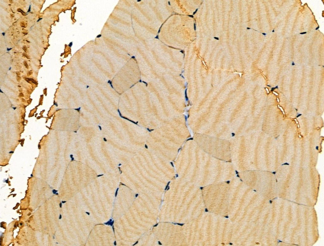 Aldolase Antibody in Immunohistochemistry (Paraffin) (IHC (P))