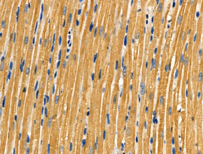 Aldolase Antibody in Immunohistochemistry (Paraffin) (IHC (P))