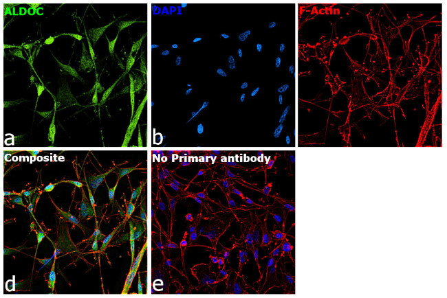 Aldolase C Antibody in Immunocytochemistry (ICC/IF)