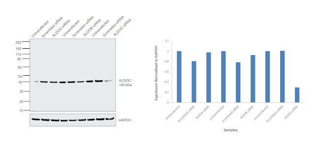 Aldolase C Antibody