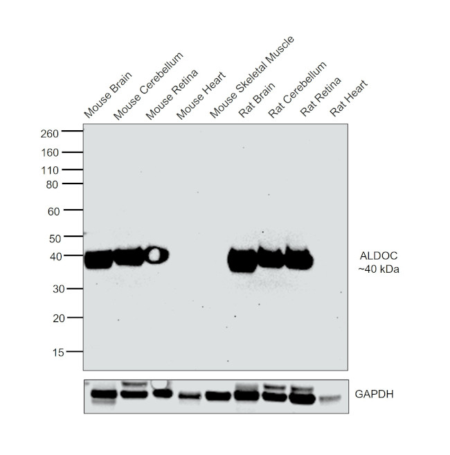 Aldolase C Antibody