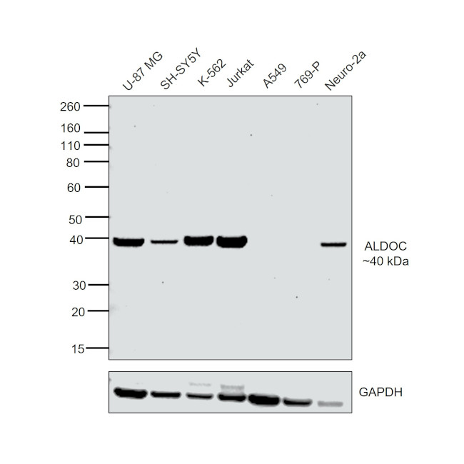 Aldolase C Antibody in Western Blot (WB)