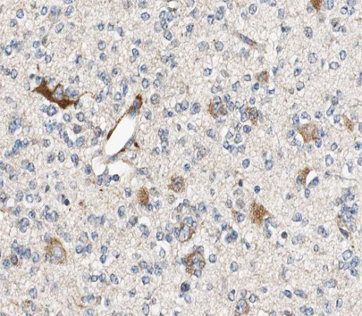 Aldolase C Antibody in Immunohistochemistry (Paraffin) (IHC (P))