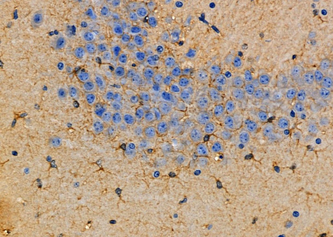 Aldolase C Antibody in Immunohistochemistry (Paraffin) (IHC (P))