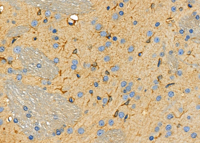 Aldolase C Antibody in Immunohistochemistry (Paraffin) (IHC (P))