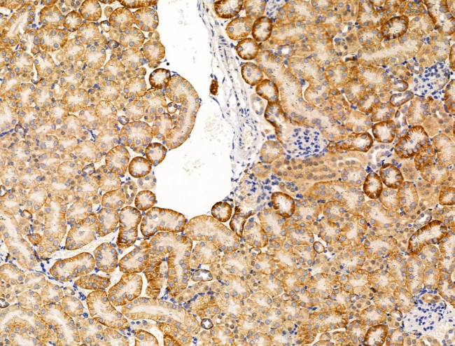 Spectrin alpha-1 Antibody in Immunohistochemistry (Paraffin) (IHC (P))