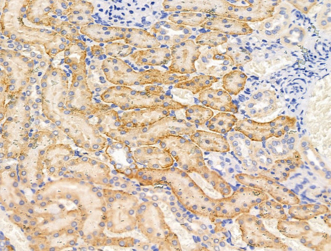 Spectrin alpha-1 Antibody in Immunohistochemistry (Paraffin) (IHC (P))