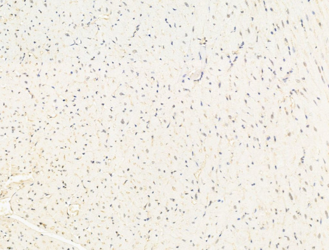 Aes Antibody in Immunohistochemistry (Paraffin) (IHC (P))