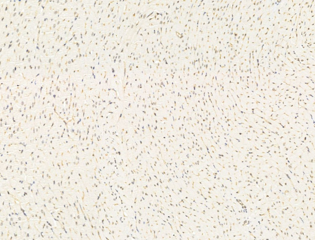 Aes Antibody in Immunohistochemistry (Paraffin) (IHC (P))