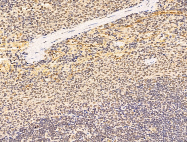 Aes Antibody in Immunohistochemistry (Paraffin) (IHC (P))