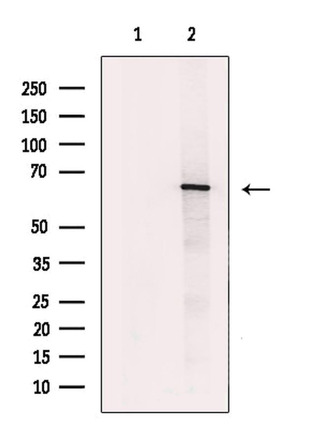 AMPK alpha-1,2 Antibody in Western Blot (WB)