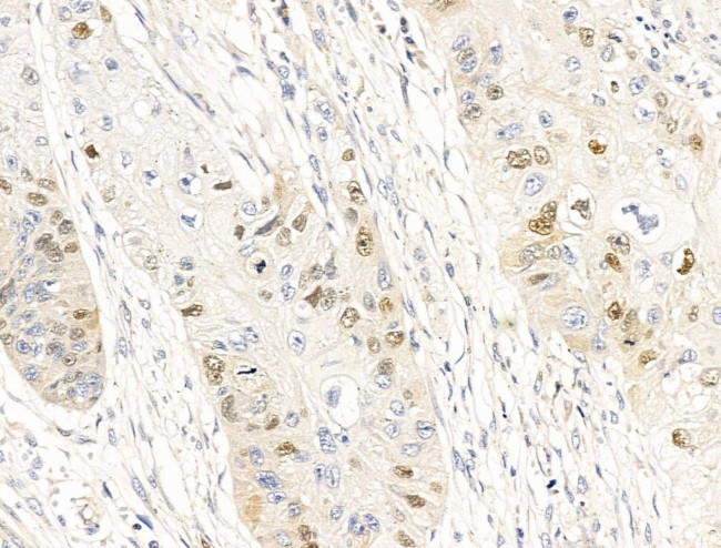 Anillin Antibody in Immunohistochemistry (Paraffin) (IHC (P))