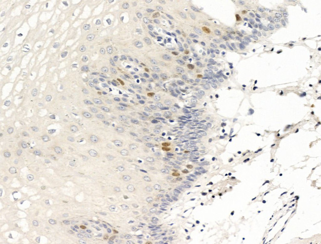 Anillin Antibody in Immunohistochemistry (Paraffin) (IHC (P))