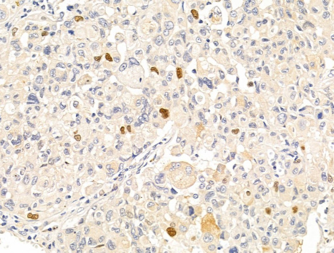 Anillin Antibody in Immunohistochemistry (Paraffin) (IHC (P))