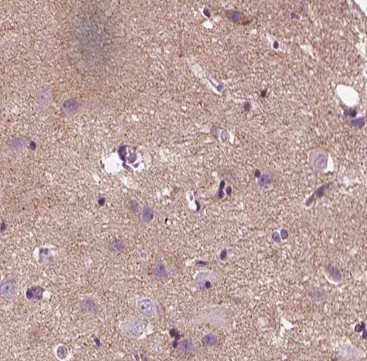 Protein APC Antibody in Immunohistochemistry (Paraffin) (IHC (P))