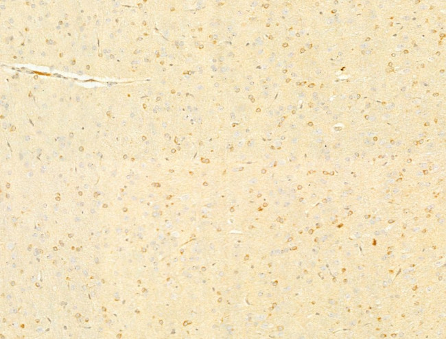 Protein APC Antibody in Immunohistochemistry (Paraffin) (IHC (P))