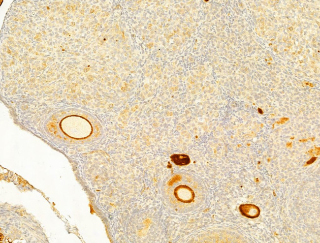 Protein APC Antibody in Immunohistochemistry (Paraffin) (IHC (P))