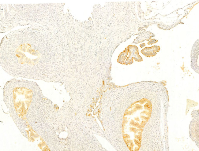 Protein APC Antibody in Immunohistochemistry (Paraffin) (IHC (P))