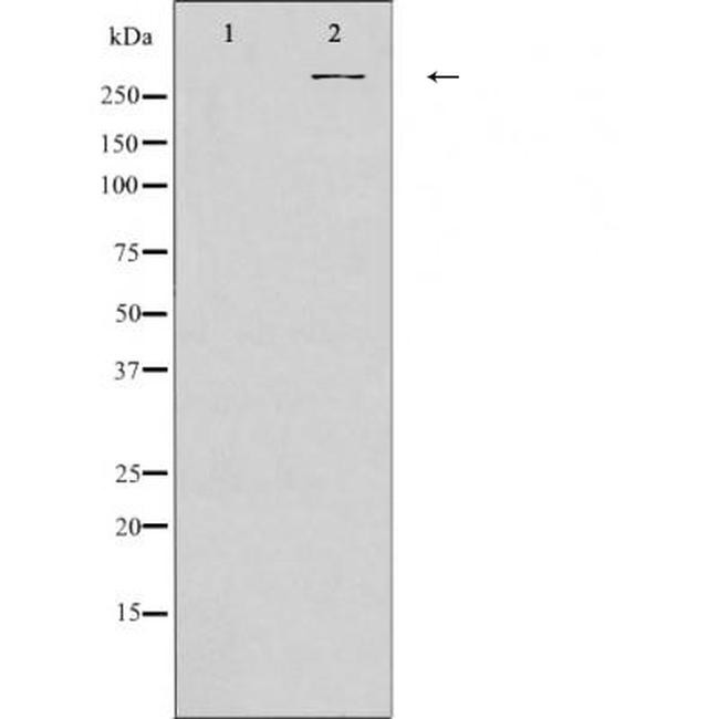 Protein APC Antibody in Western Blot (WB)