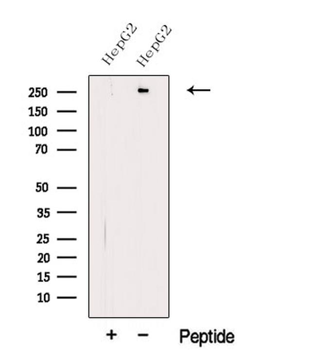 Apolipoprotein B Antibody in Western Blot (WB)