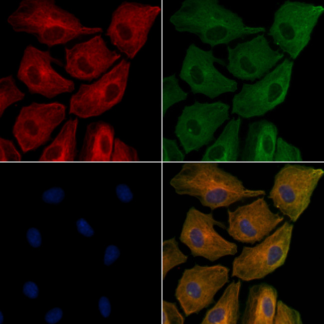 ApoC3 Antibody in Immunocytochemistry (ICC/IF)