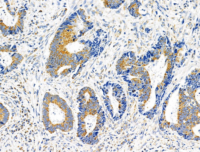 APPL1 Antibody in Immunohistochemistry (Paraffin) (IHC (P))