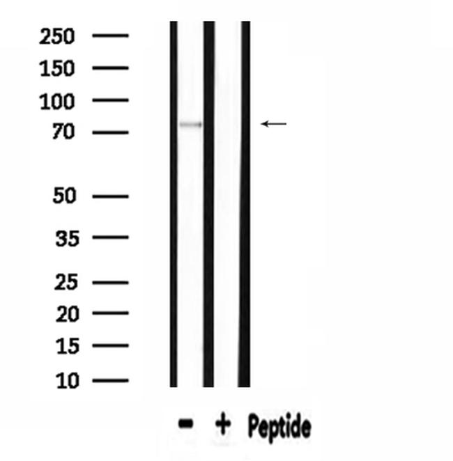 APPL1 Antibody in Western Blot (WB)