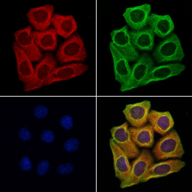 Aquaporin 9 Antibody in Immunocytochemistry (ICC/IF)